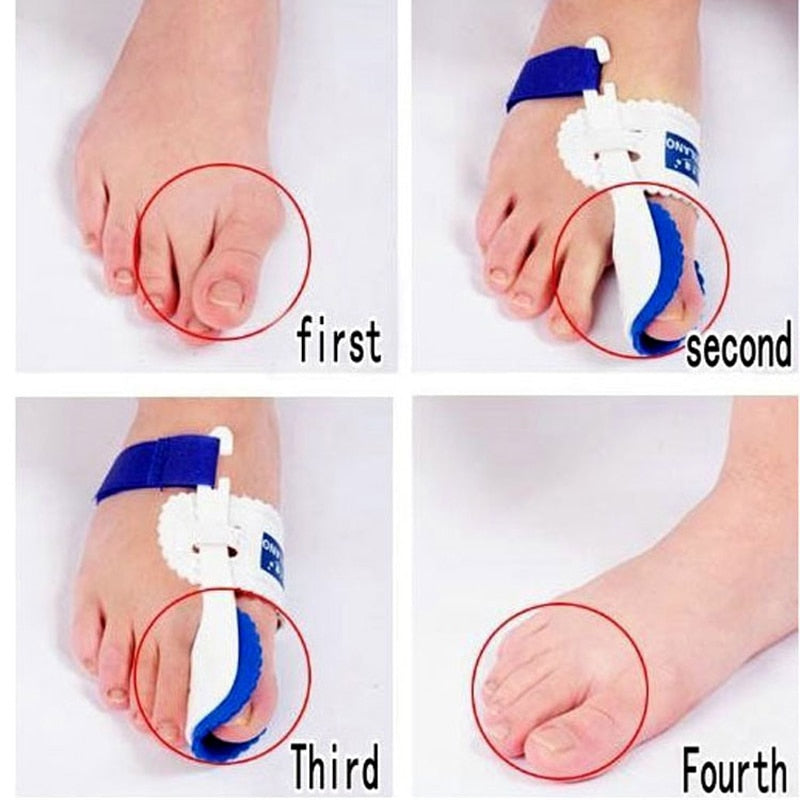 Orthopedic Bunion Corrector